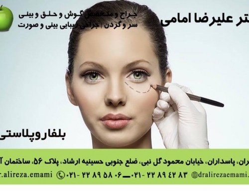 بلفاروپلاستی