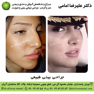 جراحی بينی طبيعی