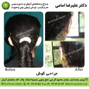 جراحی گوش