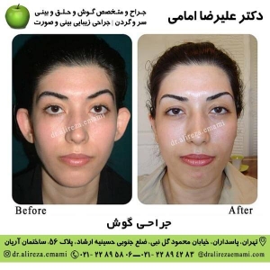جراحی گوش