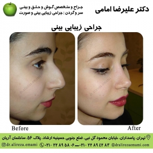 بهترین جراح بینی تهران