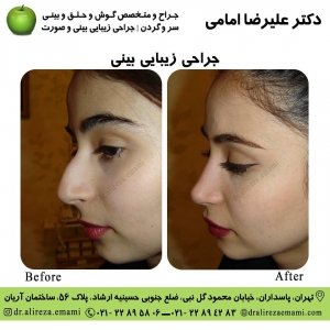 بهترین جراح بینی تهران