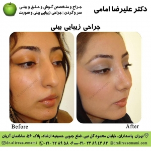 بهترین جراح بینی تهران