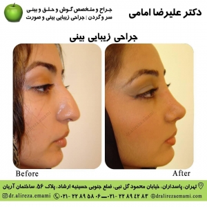 بهترین جراح بینی تهران