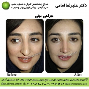 جراح بینی تهران