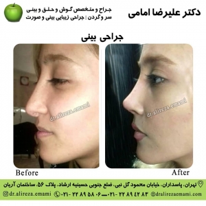 جراحی بینی فانتزی