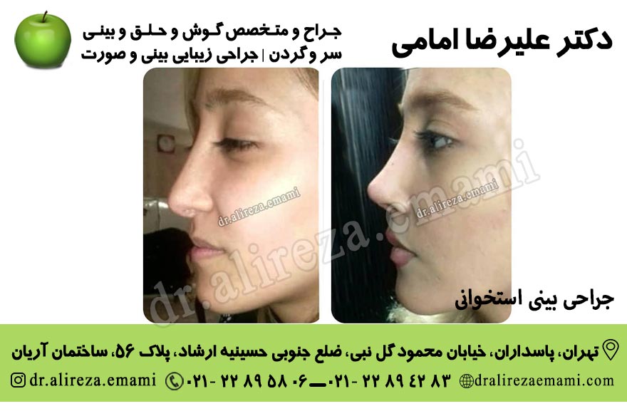 جراحی بینی فانتزی