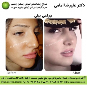 جراحی بینی فانتزی