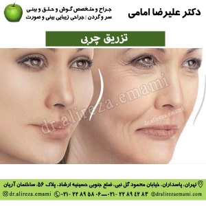 تزریق چربی