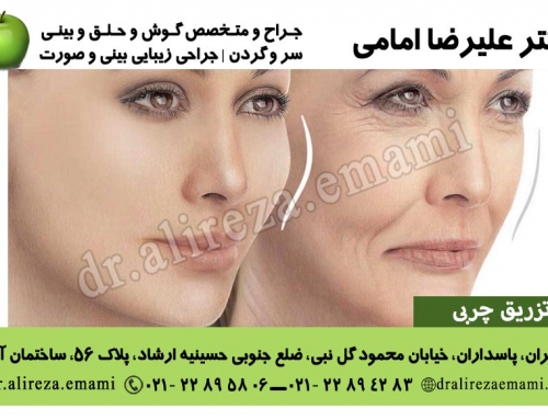 تزریق چربی