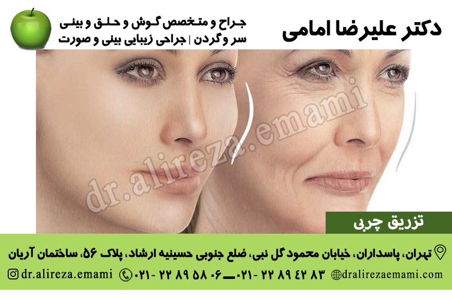 تزریق چربی