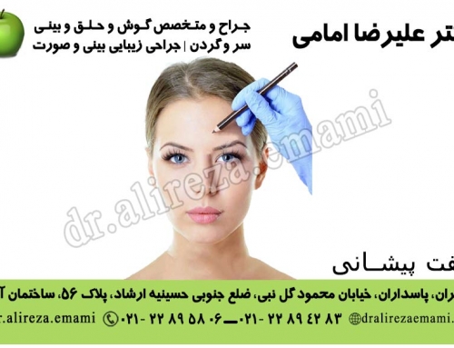 لیفت پیشانی