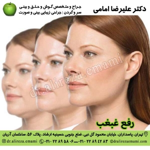 رفع غبغب