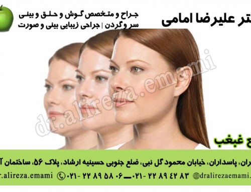 رفع غبغب