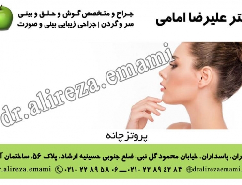 پروتز چانه