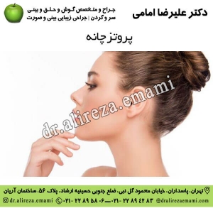 پروتز چانه