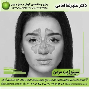 سینوزیت مزمن