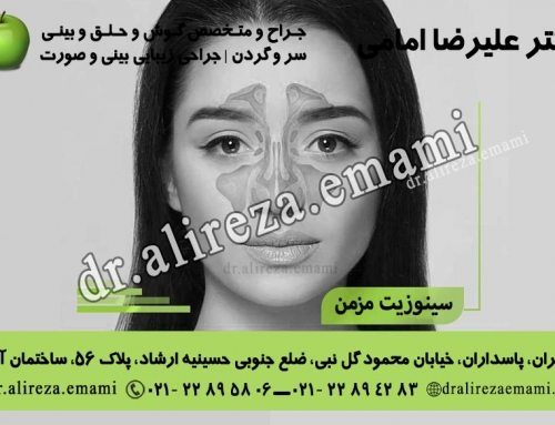 سینوزیت مزمن