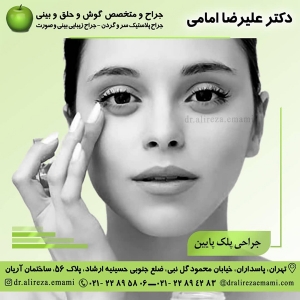 بلفاروپلاستی