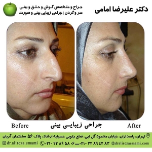 بهترین جراح بینی تهران