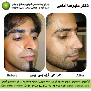 بهترین جراح بینی تهران