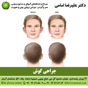 جراحی گوش