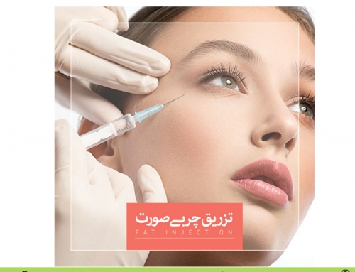 تزریق چربی صورت