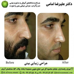 بهترین جراح بینی تهران