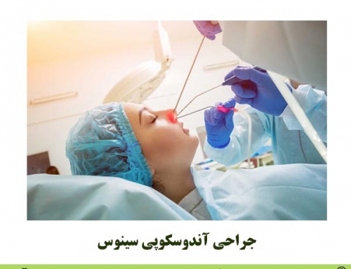 جراحی آندوسکوپی سینوس