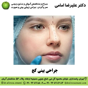 جراحی بینی کج